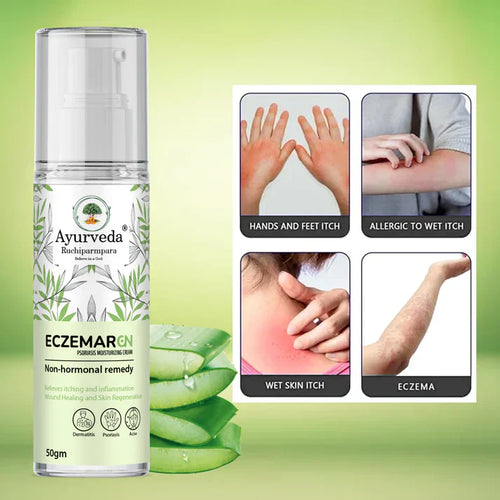 Eczemar GN – Ayurvedic Psoriasis & Eczema Moisturizing Cream